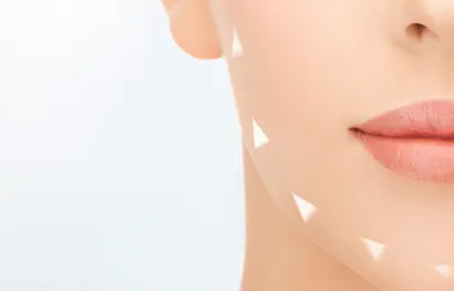 Cirurgia Plástica das Bochechas ( Bichectomia )